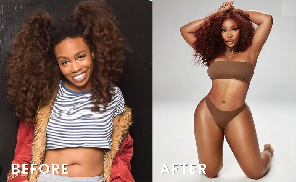 SZA before and after bbl surgery transformation