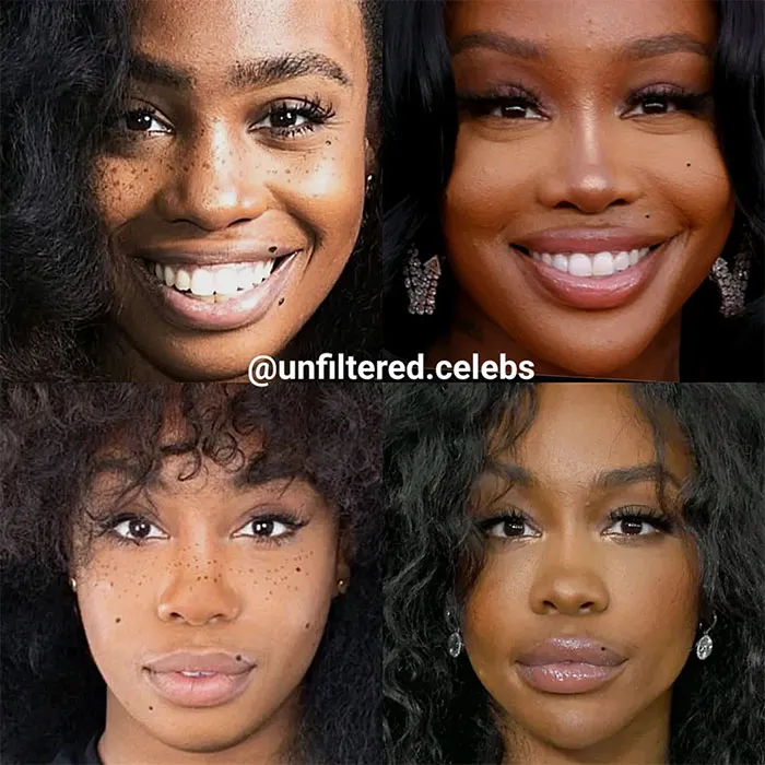 sza before and after face transformation - lips and nose plastic surgery
