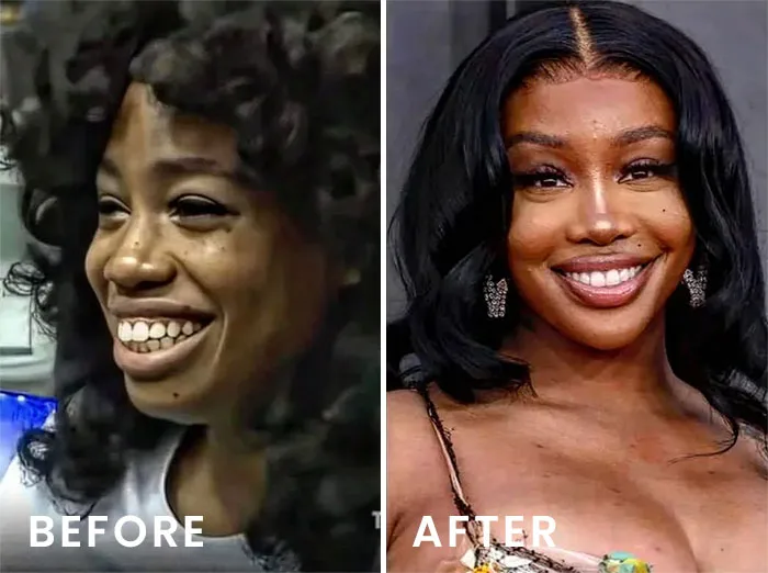 sza before and after face