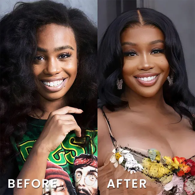 sza before and after glow up body surgery & breast implants