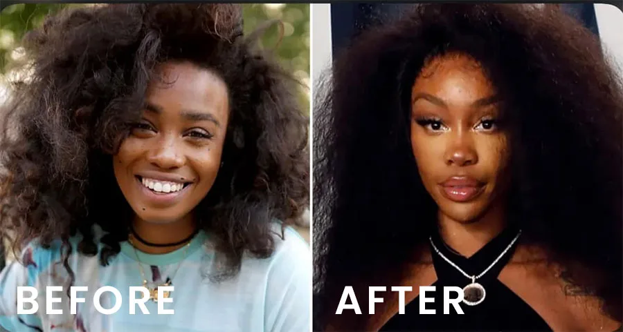 sza before and after plastic surgery face
